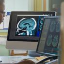 Healthcare worker with MRI image working on a computer